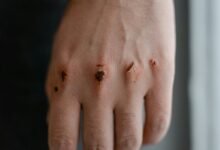 sensitive skin safety tips