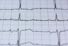 revenue node analysis 686139311